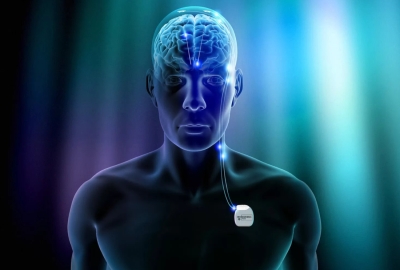 No Image Caption